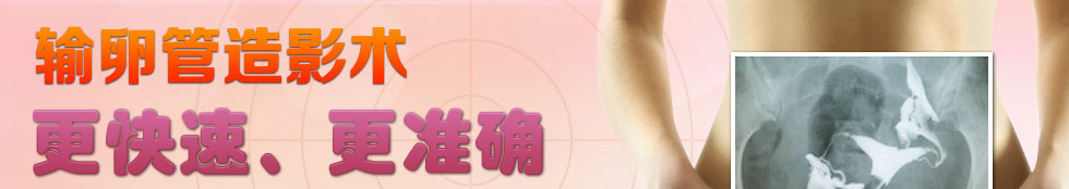 输卵管造影 更快速 更准确